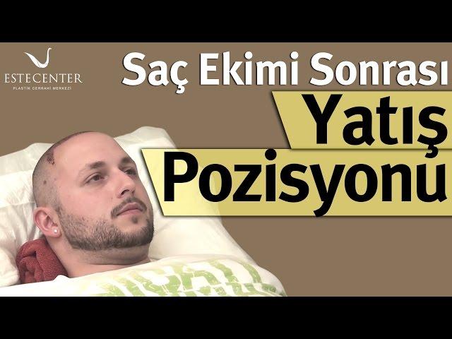 Saç Ekimi Sonrası Yatış Pozisyonu Nasıl Olmalıdır?