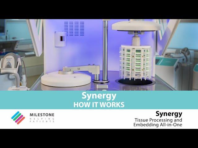 Synergy Auto-Embedding System - How it works