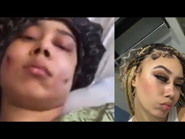 HOUSTON RAPPER SKYTHEFINEST GETS SHOT IN THE FACE AND BRAGS ON SOCIAL MEDIA ‍️