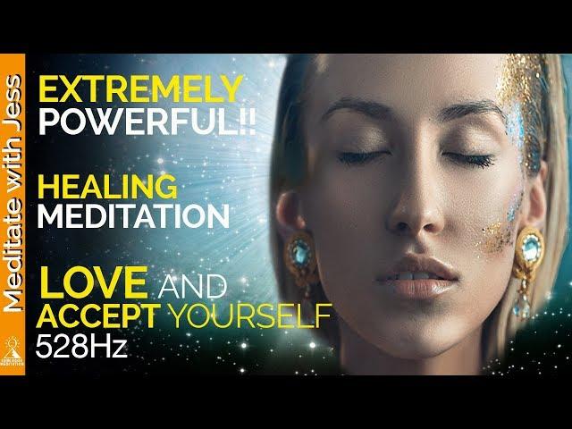 Extremely Powerful Guided Meditation.  Experience Deep Love And Acceptance For Yourself.  Healing.