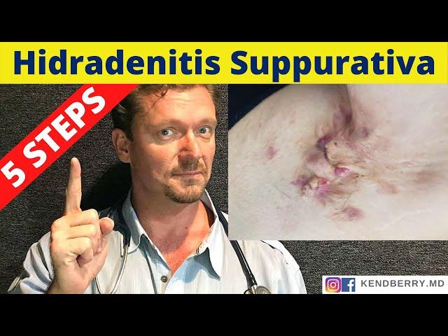 HYDRADENITIS SUPPURATIVA (5 Steps to Reverse HS)