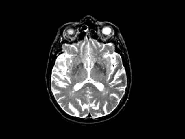 Atlas of normal structure and blood flow