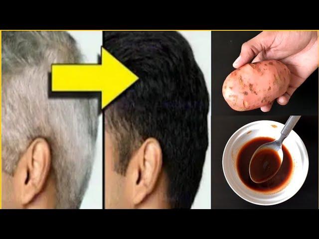 From white hair to black hair naturally in just 4 minutes permanently!  100% works!