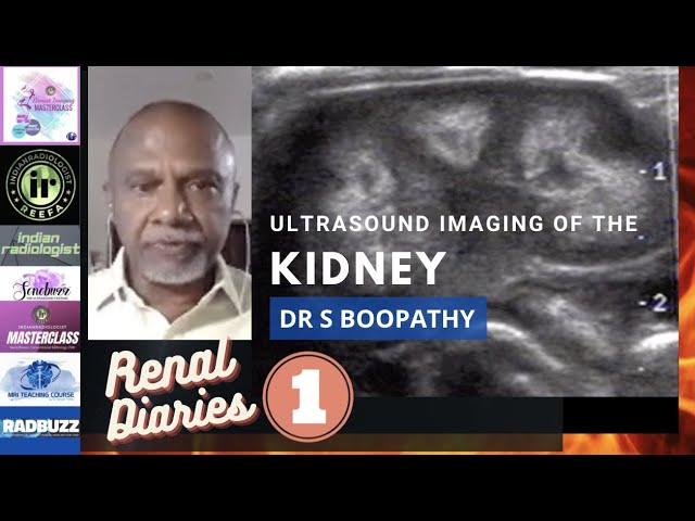 ULTRASOUND IMAGING OF THE KIDNEYS || DR S BOOPATHY || ANATOMY, VARIATIONS, TIPS AND TRICKS ON USG