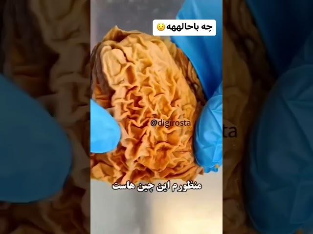 اناتومی معده