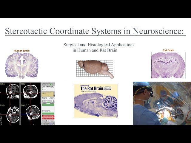 Stereotactic Coordinate Systems in Neuroscience and Medicine: Applications in Rat and Human Brain