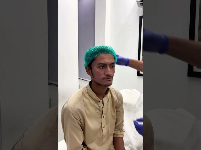 Combination Treatment Done by DR Malik Rizwan #trending #shorts #youtubeshorts #viralshorts #video