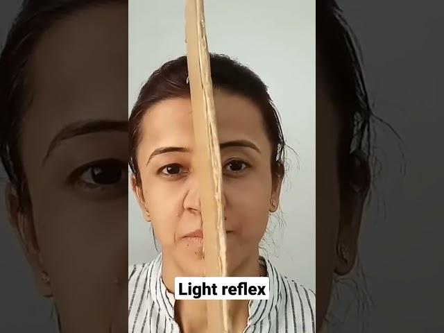 Light reflex