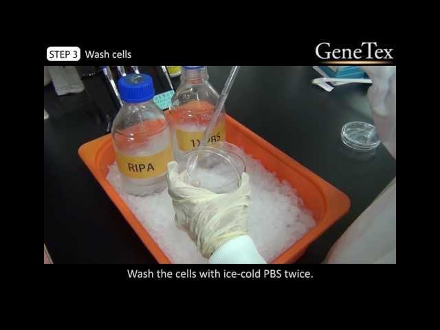 Western Blot - Sample preparation      [Video from GeneTex]