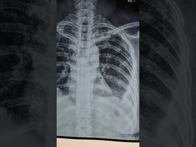 differential diagnosis?