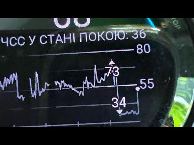 Відповіді на запитання про насиль-ство в церкві. Особистий досвід. «Нотатки дружини пастора», #390