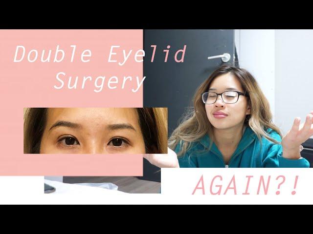 Double Eyelid Surgery in Korea... AGAIN?!  |  Watch Me Recover (Non-Incisional)