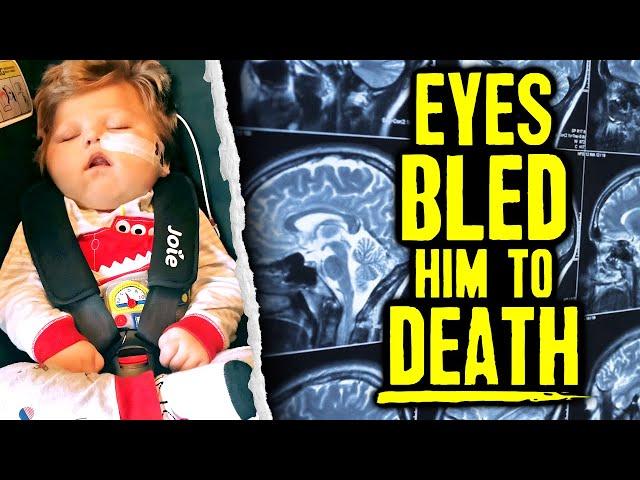 Infant’s Brain Torn & Eyes Bled Him To Death