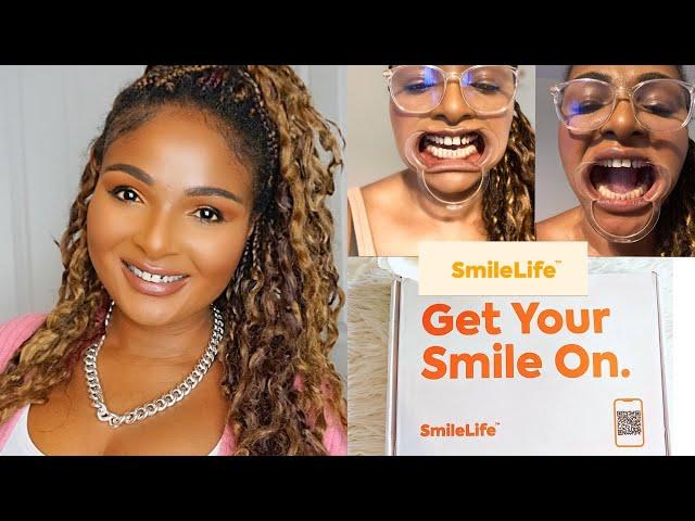 STRAIGHTENING MY TEETH WITH SMILELIFE CLINIC #smilelife #teethstraightening #invisiblealigners