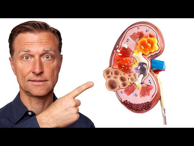 The TOP Best Foods to Improve Kidney Function (END STAGE KIDNEY DISEASE)