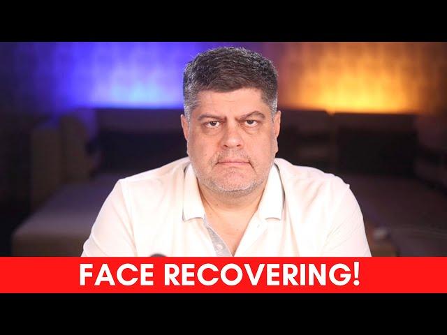 THE FACE IS RECOVERING! A Health Update, An Apology, A Brief News Update, Some Plans