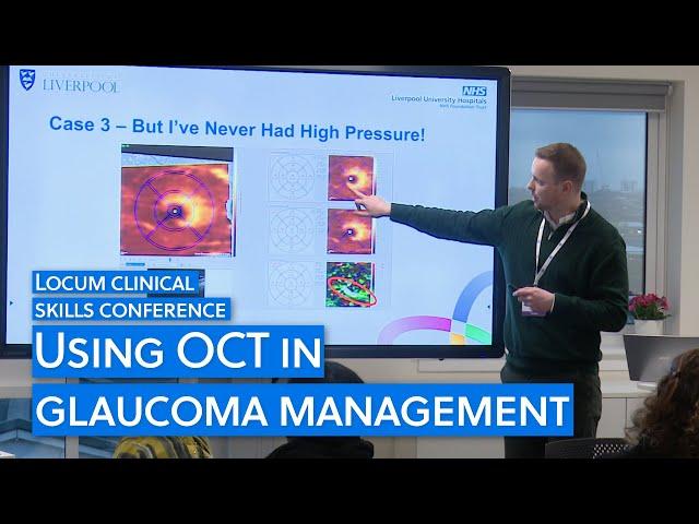 How to use OCT for glaucoma management