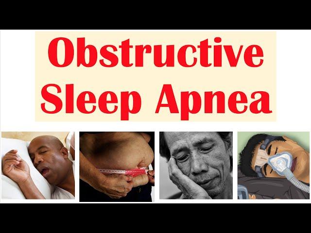 Obstructive Sleep Apnea (OSA) | Risk Factors, Signs & Symptoms, Complications, Diagnosis, Treatment