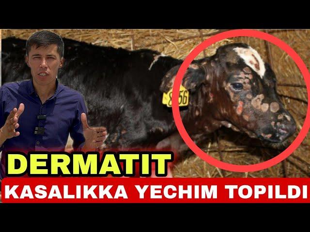 DERMATIT YANI GUL KASALIKKA YECHIM TOPILDI