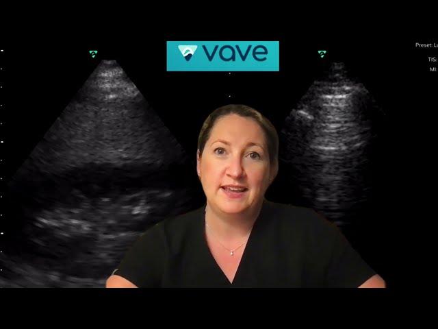 POCUS in Primary Care  |  April EduCast  |  Vave Health