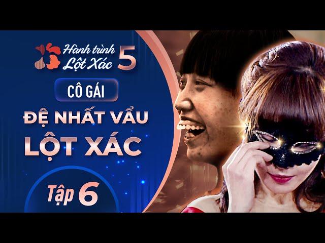 Hành Trình Lột Xác mùa 5 | Tập 6: Vũ Thị Hợp - Cô gái "đệ nhất Vẩu" lột xác