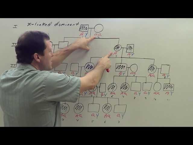 X Linked Dominant Pedigree