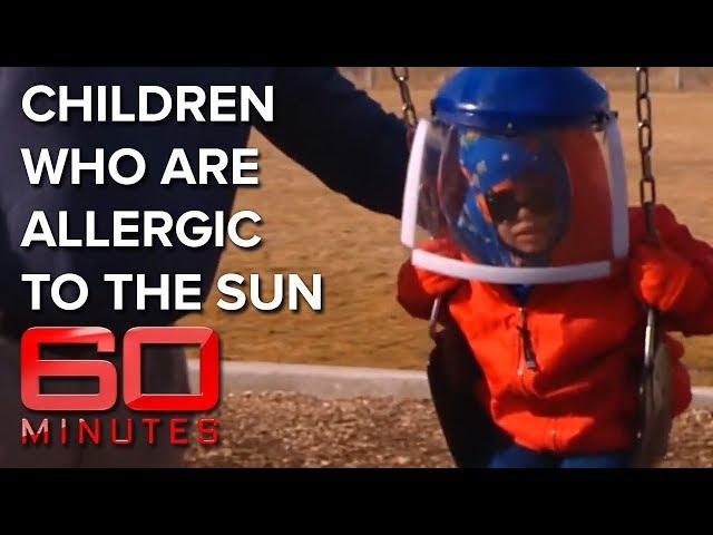 Children of the Night: Young kids allergic to the sun | 60 Minutes Australia