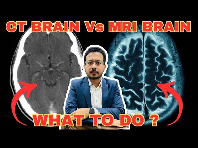 CT Brain Vs MRI Brain  Kaunsa brain scanning better hai ?