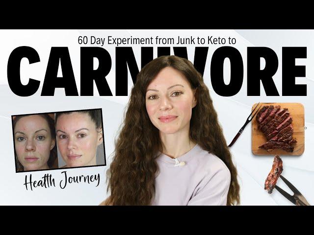 CARNIVORE Experience: Journey from Junk-food to Keto to Carnivore [Hashimotos]