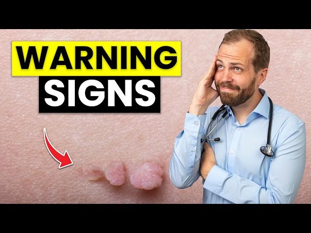 Skin Tags: What Do They REALLY Mean? (Don't miss this warning sign)