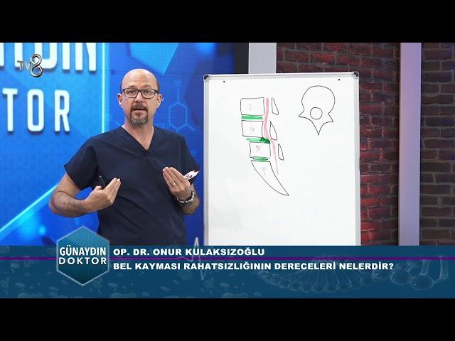 BEL KAYMASI RAHATSIZLIĞININ DERECELERİ NELERDİR? OP. DR. ONUR KULAKSIZOĞLU