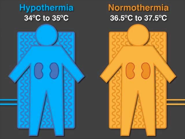 Keeping Cool - Therapeutic Hypothermia in Deceased Organ Donors and Kidney-Graft Function