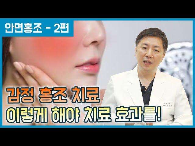 교감신경차단술을 통한 감정홍조 치료 이렇게 합니다! [안면 홍조 - 2편]