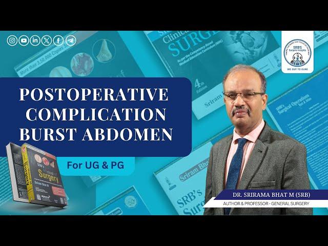 Postoperative Complication Burst Abdomen By Dr. SRB | Dr. Srirama Bhat