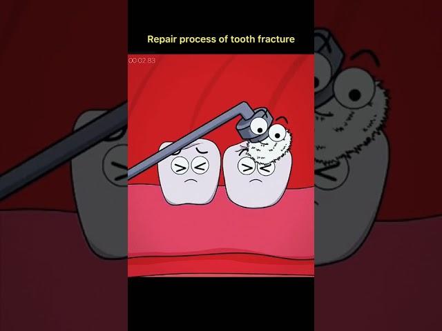 process of teeth fracture