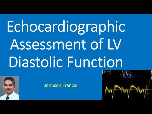 Echocardiographic Assessment of LV Diastolic Function