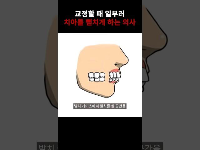 교정하고 있는데 왜 치아가 더 이상 해지죠? #shorts