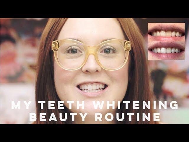 My Teeth Whitening Beauty Routine (WITH BEFORE AND AFTER PHOTOS) | Ginger Me Glam