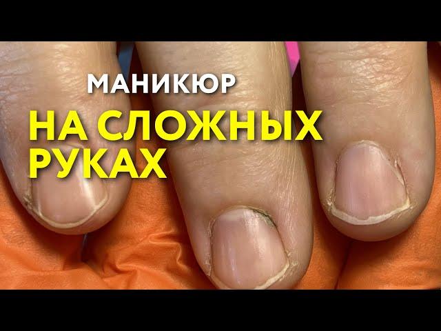 Маникюр на сложных руках