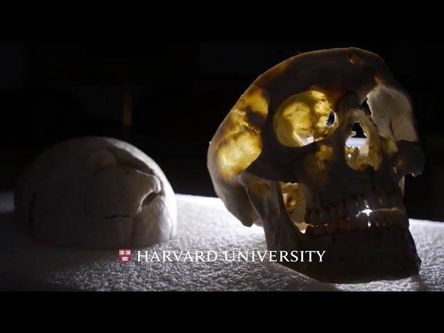 Lessons of the brain: the Phineas Gage case