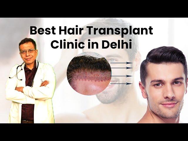 Best Hair Transplant Surgeon Clinic in Delhi at Care Well Medical Centre