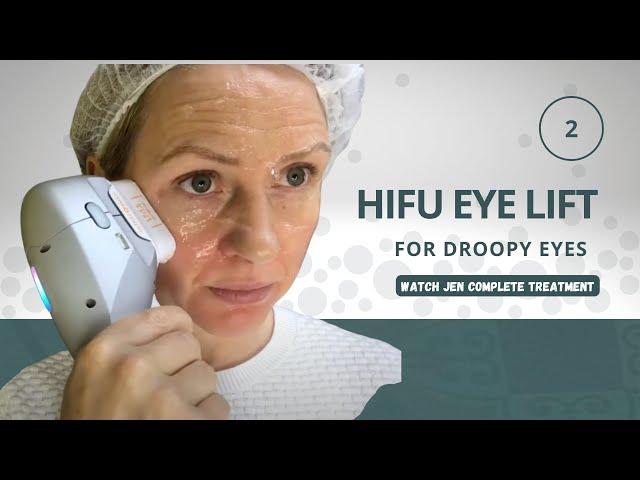 Unlocking Youthful Eyes: HIFU Eye Lift Revealed