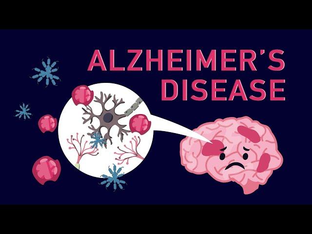 What is Alzheimer’s Disease?