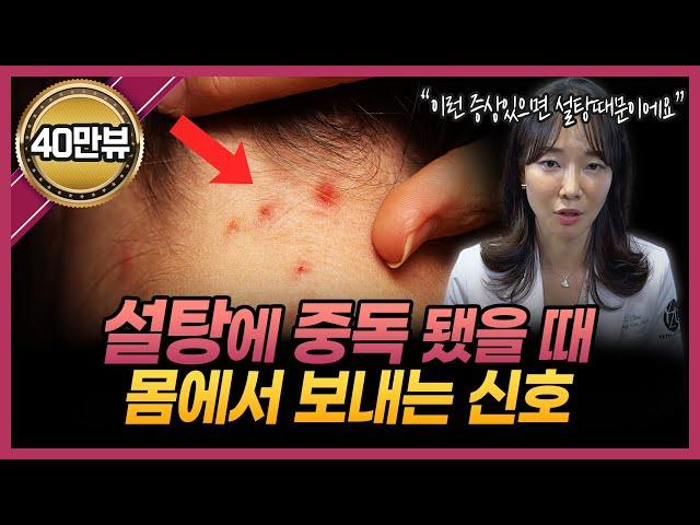 당신이 설탕을 너무 많이 섭취하고 있다는 8가지 징후