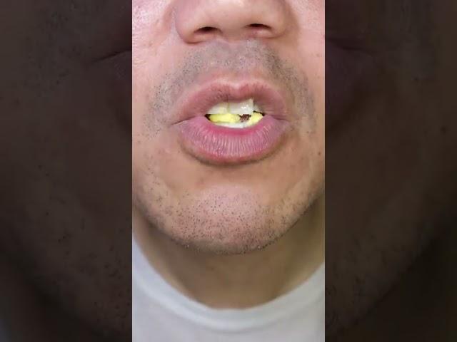 ASMR | Skittles | Yummy Yogurt Flavour #DoctorTristanPeh #Skittles #ASMR