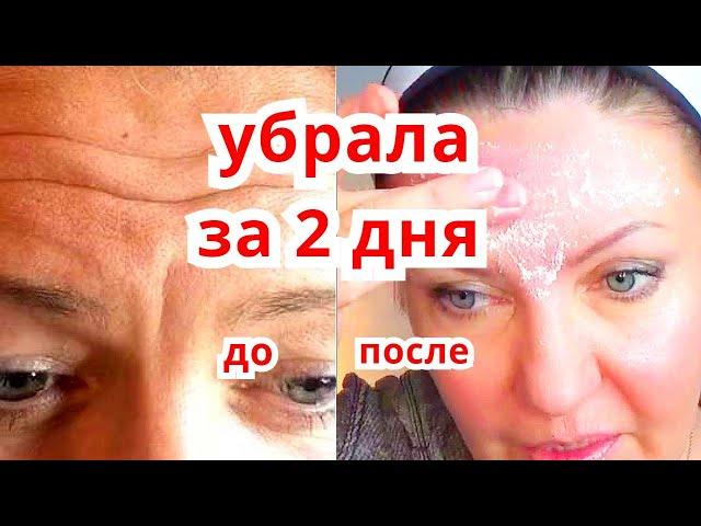 Super Mask for Wrinkles on the Forehead and Brow Wrinkles Removed in Just 3 Days