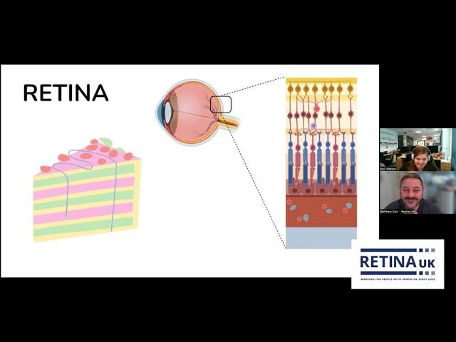 “Mini-Retina” – A tool to unlock the future of restored vision in retinal blindness