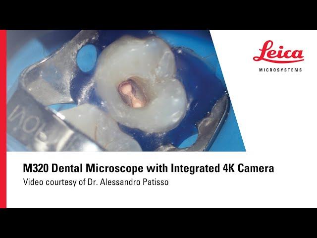 Micro Dentistry Video Recorded by M320 Dental Microscope with 4K Camera