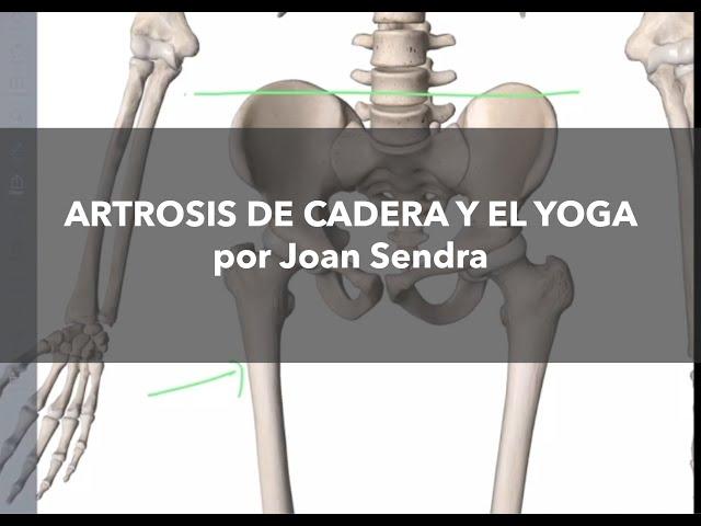 Artrosis de Cadera y el Yoga