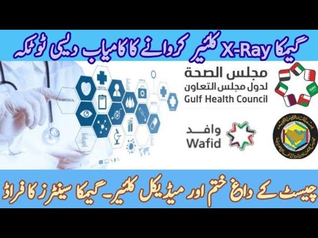 How to Clear GAMCA X-Ray | GAMCA Medical Mafia | GAMCA Medical Status | GAMCA Medical Check